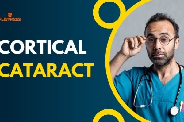 Cortical Cataract